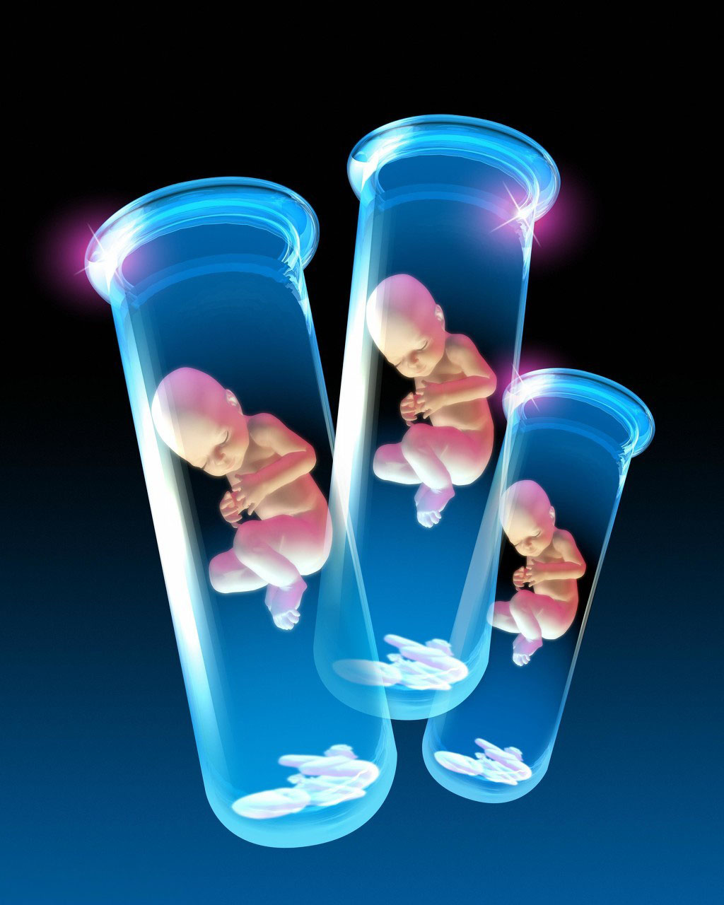 试管婴儿取卵手术过程演示