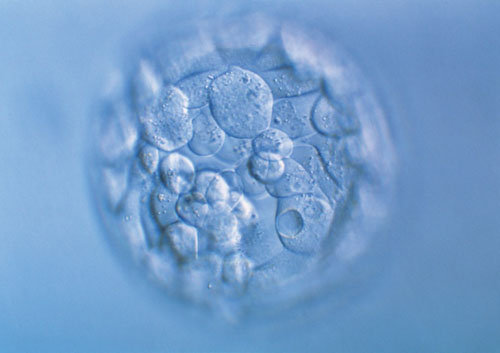 试管婴儿助孕网  -＞  胚胎移植